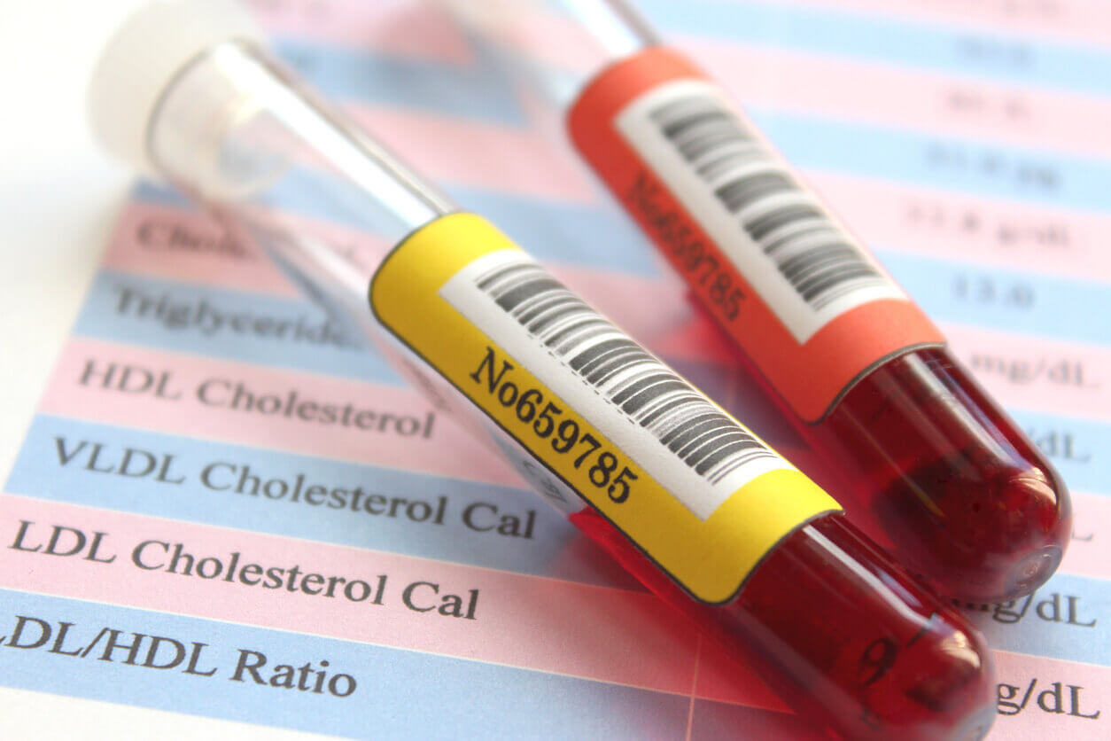 Sample of blood collection for a cholesterol test.